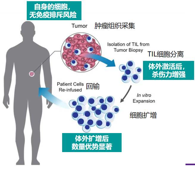 TIL 治疗原理：从患者肿瘤组织分离 TIL，经体外激活扩增后回输