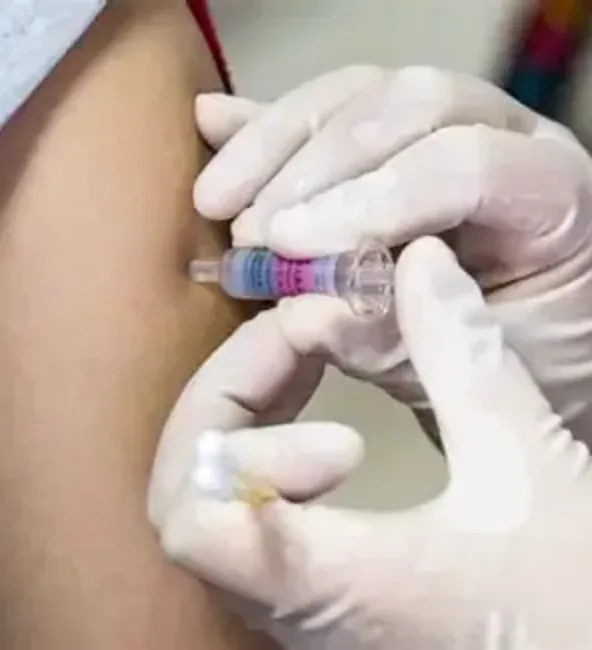 AVL-101 DNA 治疗性 HPV 疫苗